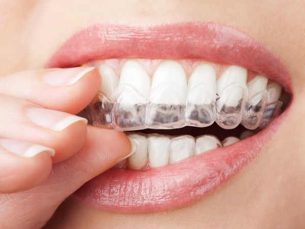 De bijna onzichtbare beugel: Invisalign Orthodontist Winschoten R.G.